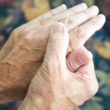 Understanding The Symptoms Of Rheumatoid Arthritis