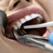 ￼4 Common Dental Emergencies That Require Immediate Attention